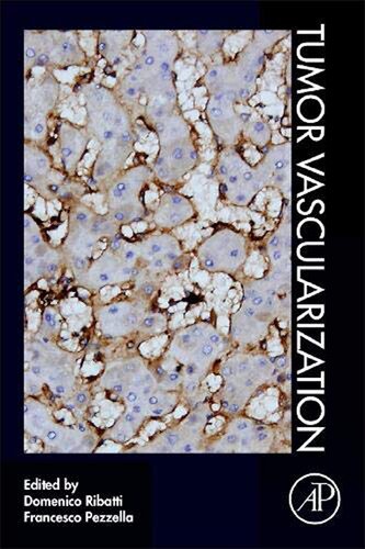 Ribatti D Tumor Vascularization Domenico Ribatti Editor Francesco Pezzella Editor