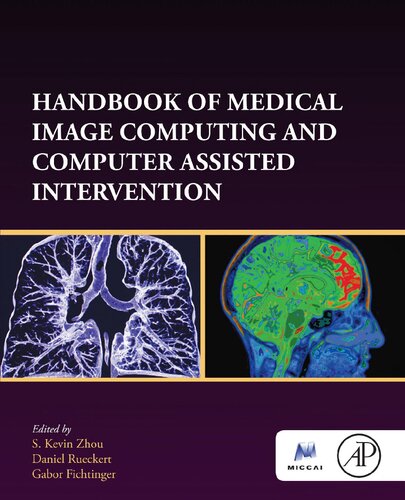 Handbook Of Medical Image Computing And Computer Assisted Intervention Elsevier And Miccal Society S Kevin Zhou Editor