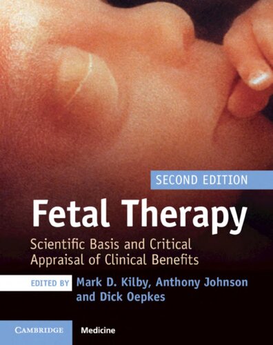 Fetal Therapy Scientific Basis And Critical Appraisal Of Clinical Benefits 2nd Edition Mark D Kilby Editor