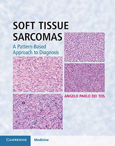 Soft Tissue Sarcomas Hardback With Online Resource A Patternbased Approach To Diagnosis 1st Edition Angelo Paolo Dei Tos