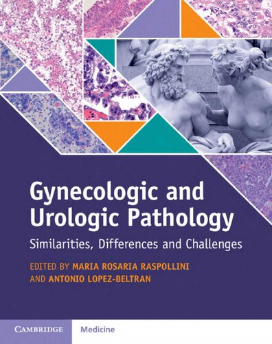 Gynecologic And Urologic Pathology Similarities Differences And Challenges Maria Rosaria Raspollini