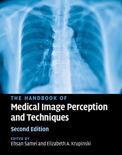 The Handbook Of Medical Image Perception And Techniques 2nd Edition Ehsan Samei Editor
