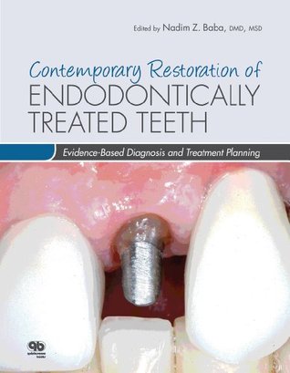 Contemporary Restoration Of Endodontically Treated Teeth Evidencebased Diagnosis And Treatment Planning Hardcover Nadim Z Baba