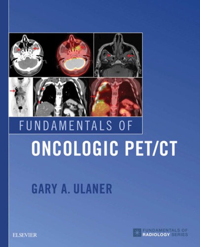 Fundamentals Of Oncologic Petct 1st Gary Ulaner