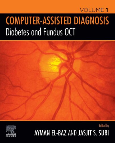 Diabetes And Fundus Oct Ayman S Elbaz Editor Jasjit S Suri Editor