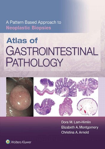 Atlas Of Gastrointestinal Pathology A Pattern Based Approach To Neoplastic Biopsies Christina Arnold Dora Lamhimlin Elizabeth A Montgomery