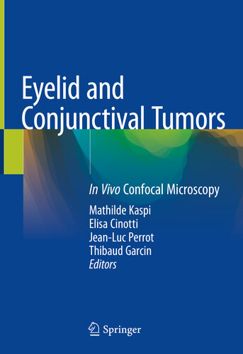Eyelid And Conjunctival Tumors In Vivo Confocal Microscopy 1st Edition Mathilde Kaspi Editor