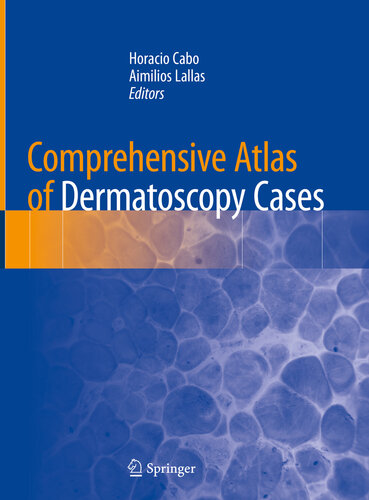 Comprehensive Atlas Of Dermatoscopy Cases Horacio Cabo Aimilios Lallas