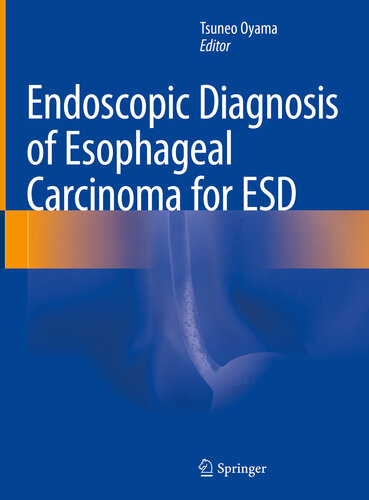 Endoscopic Diagnosis Of Esophageal Carcinoma For Esd Tsuneo Oyama