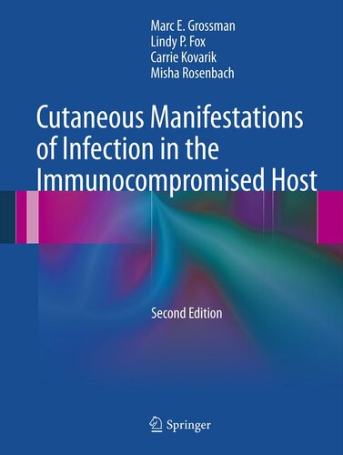 Cutaneous Manifestations Of Infection In The Immunocompromised Host 2nd Edition Marc E Grossman