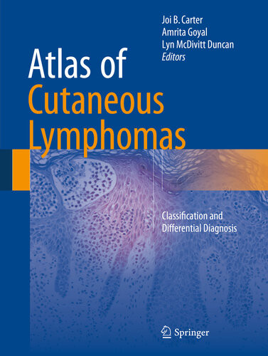 Atlas Of Cutaneous Lymphomas Classification And Differential Diagnosis Joi B Carter Amrita Goyal Lyn Mcdivitt Duncan