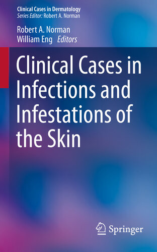 Clinical Cases In Infections And Infestations Of The Skin Robert A Norman William Eng
