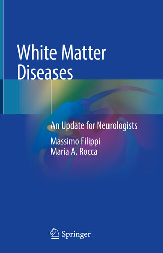 White Matter Diseases An Update For Neurologists Massimo Filippi Maria A Rocca