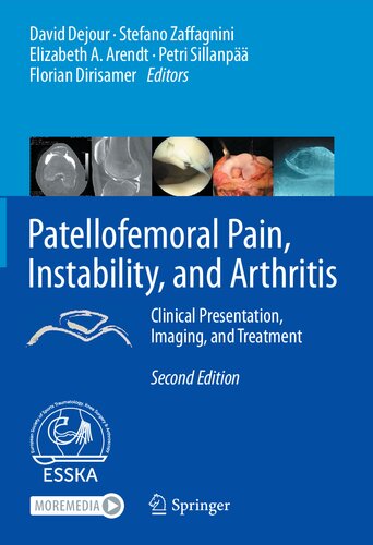 Patellofemoral Pain Instability And Arthritis Clinical Presentation Imaging And Treatment 2nd Edition D Dejour