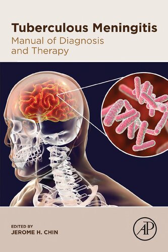 Tuberculous Meningitis Manual Of Diagnosis And Therapy Jerome H Chin Editor