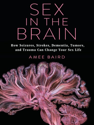 Sex In The Brain How Seizures Strokes Dementia Tumors And Trauma Can Change Your Sex Life Amee Baird