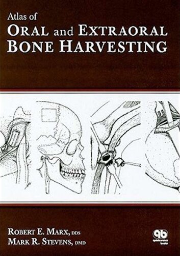 Atlas Of Oral And Extraoral Bone Harvesting 1st Edition Robert E Marx