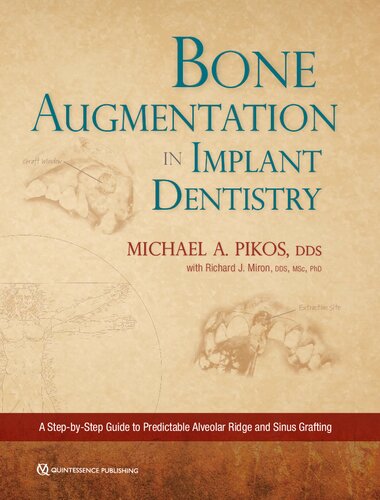 Bone Augmentation In Implant Dentistry A Stepbystep Guide To Predictable Alveolar Ridge And Sinus Grafting 1st Edition Michael A Pikos