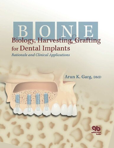Bone Biology Harvesting And Grafting For Dental Implants Rationale And Clinical Applications Arun K Garg