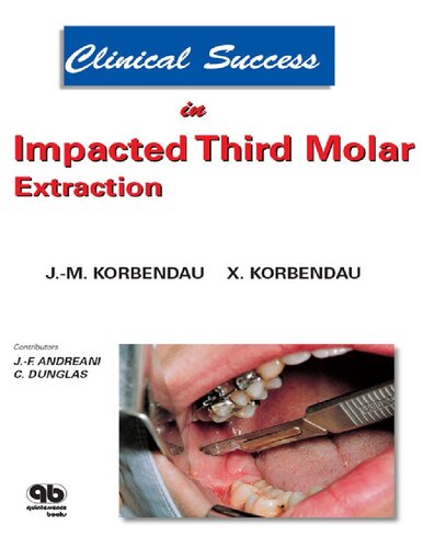 Clinical Success In Impacted Third Molar Extraction Jeanmarie Korbendau Xavier Korbendau