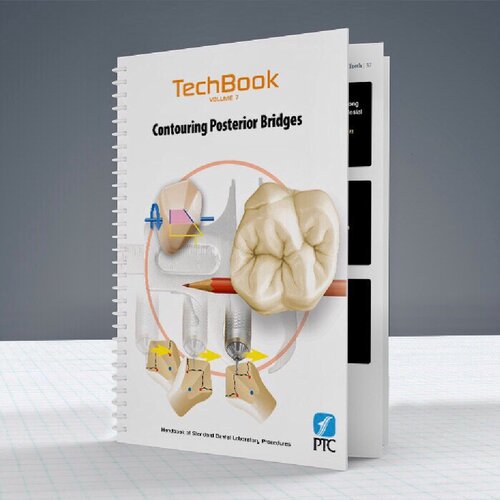 Contouring Posterior Bridges John C Ness James Mahan Mark Larson