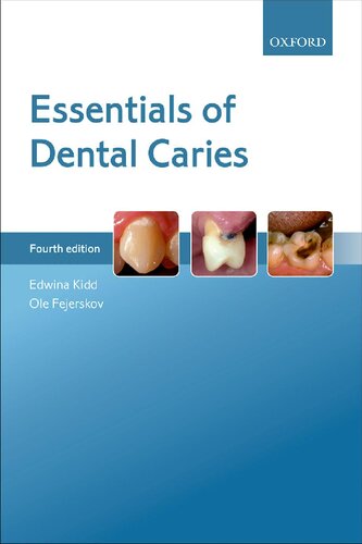 Essentials Of Dental Caries Edwina Kidd Ole Fejerskov
