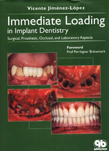 Immediate Loading In Implant Dentistry Surgical Prosthetic Occlusal And Laboratory Aspects Vincente Jimenezlopez