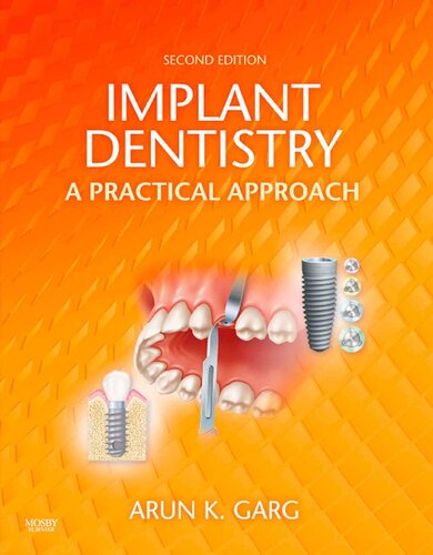Implant Dentistry A Practical Approach 2nd Edition Arun K Garg Dmd