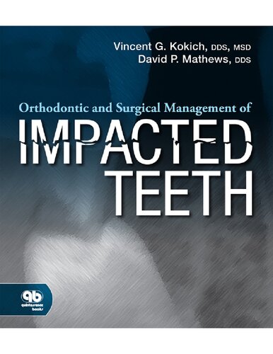 Orthodontic And Surgical Management Of Impacted Teeth 1st Edition Vincent G Kokich