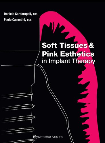 Soft Tissues And Pink Esthetics In Implant Therapy 1st Edition Daniele Cardaropoli