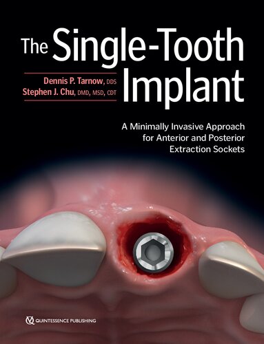 The Singletooth Implant A Minimally Invasive Approach For Anterior And Posterior Extraction Sockets 1st Edition Dennis P Tarnow