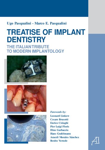 Treatise Of Implant Dentstry The Italian Tribute To Modern Implantology Ugo Pasqualini