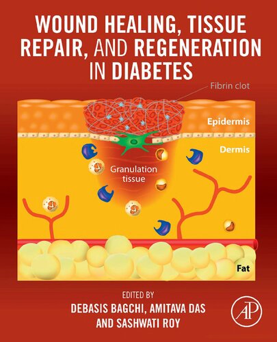 Wound Healing Tissue Repair And Regeneration In Diabetes Debasis Bagchi Editor