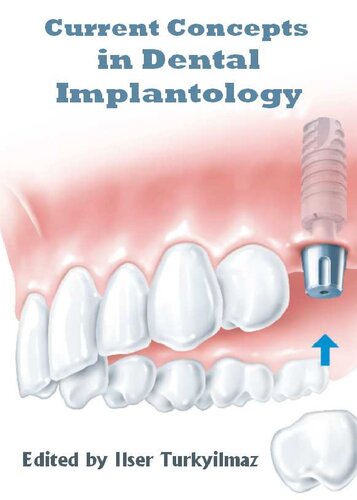 Current Concepts In Dental Implantology Ilser Turkyilmaz Editor