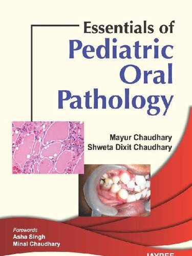 Essentials Of Pediatric Oral Pathology 1st Edition Mayur Chaudhary