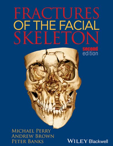 Fractures Of The Facial Skeleton 2nd Edition Michael Perry Andrew K Brown
