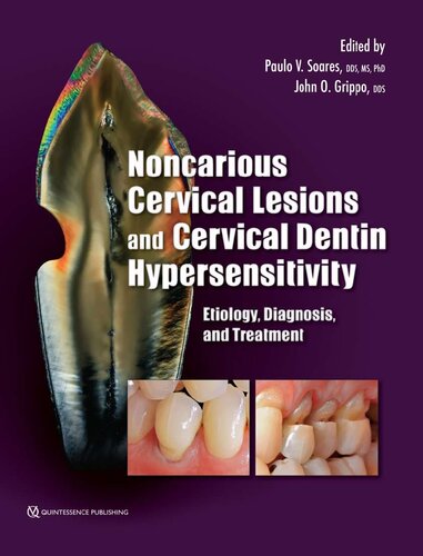 Noncarious Cervical Lesions And Cervical Dentin Hypersensitivity Etiology Diagnosis And Treatment 1st Edition Paulo V Soares