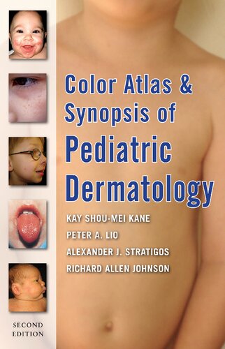 Color Atlas And Synopsis Of Pediatric Dermatology 2nd Edition Kay Shm Kane
