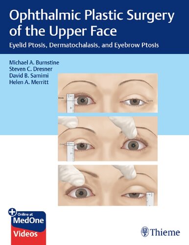 Ophthalmic Plastic Surgery Of The Upper Face Eyelid Ptosis Dermatochalasis And Eyebrow Ptosis 1st Edition Michael Burnstine