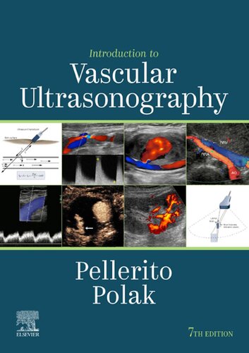 Introduction To Vascular Ultrasonography 7th Edition John Pellerito Editor