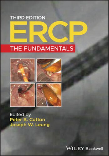Ercp The Fundamentals 3rd Edition Peter B Cotton Editor Joseph W Leung Editor