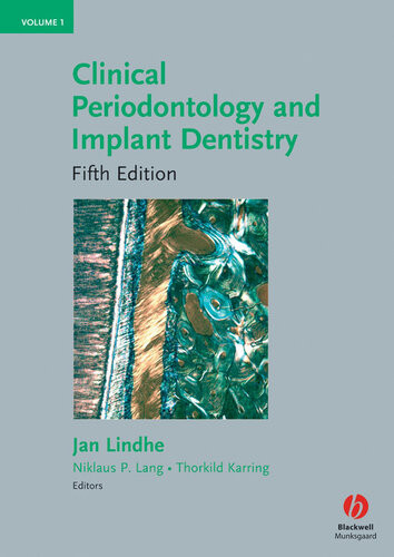 Clinical Periodontology And Implant Dentistry Jan Lindhe Niklaus P Lang Thorkild Karring