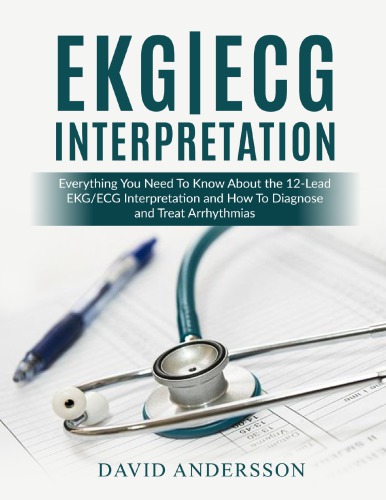 Ekgecg Interpretation Everything You Need To Know About The 12lead Ecgekg Interpretation And How To Diagnose And Treat Arrhythmias 1st David Andersson