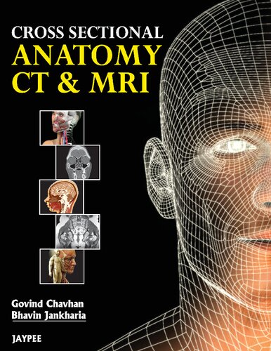 Cross Sectional Anatomy Ct And Mri 1st Edition Govind Chavhan