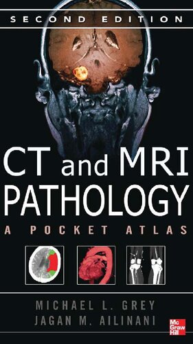Ct Mri Pathology A Pocket Atlas 2nd Jagan M Ailinani Michael L Grey