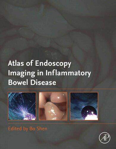 Atlas Of Endoscopy Imaging In Inflammatory Bowel Disease 1st Edition Bo Shen Md Editor