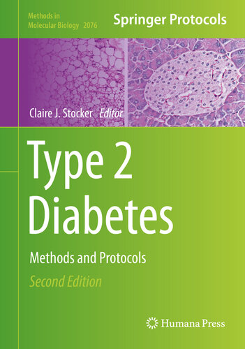 Type 2 Diabetes Methods And Protocols 2nd Ed 2nd Edition Claire J Stocker