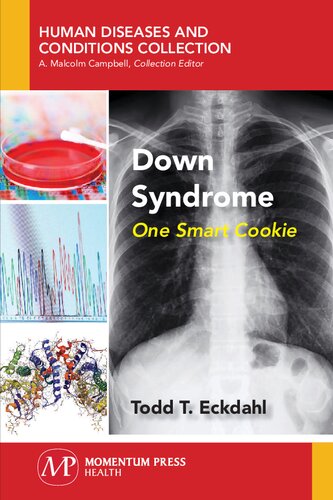 Down Syndrome One Smart Cookie First Edition Todd T Eckdahl
