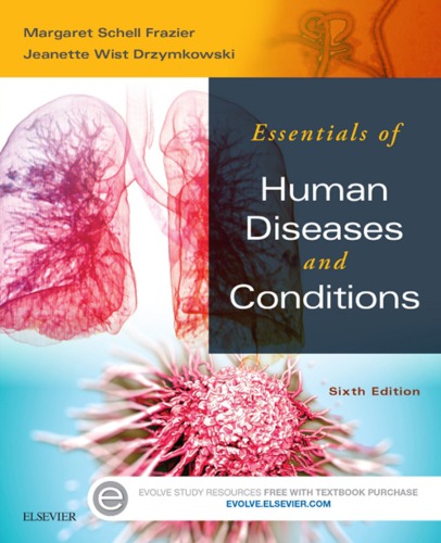 Essentials Of Human Diseases And Conditions 6th Edition Margaret Frazier