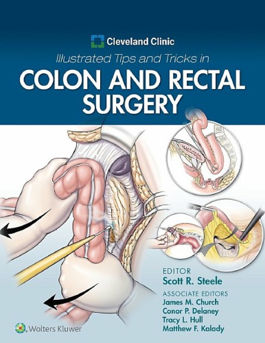 Cleveland Clinic Illustrated Tips And Tricks In Colon And Rectal Surgery 1st Scott Steele
